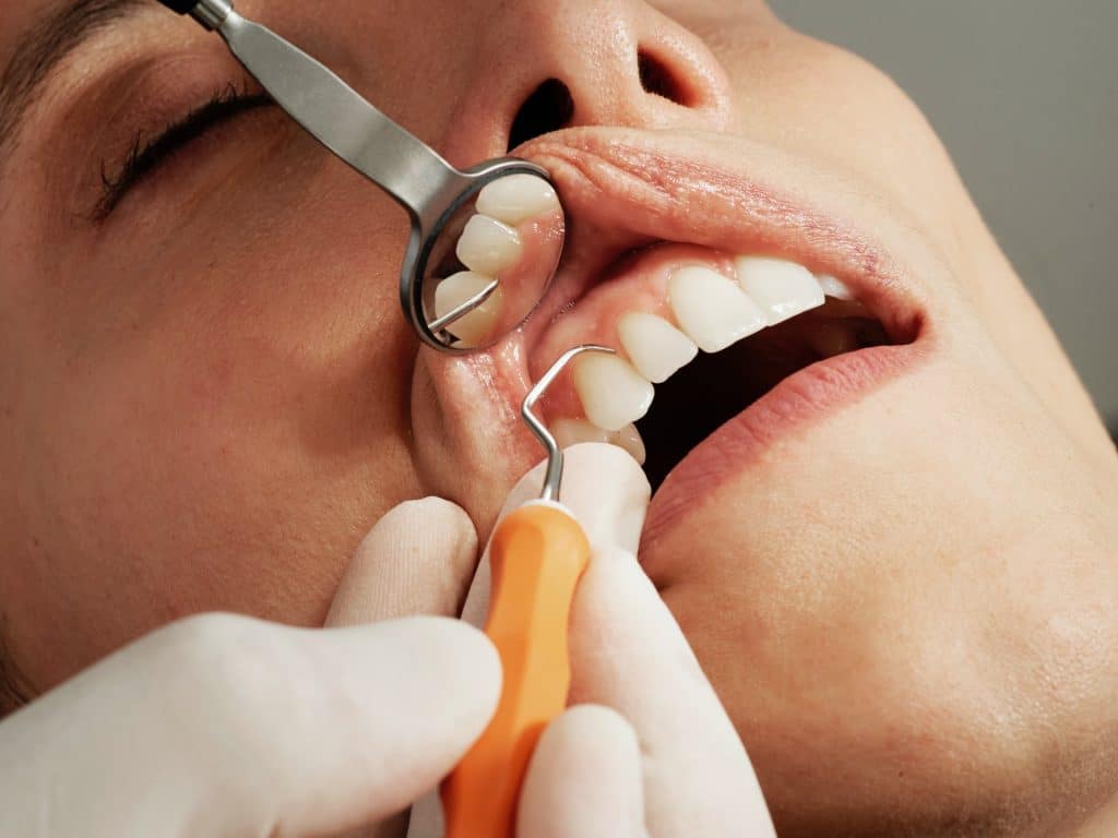 Comment avoir un rendez-vous chez le dentiste rapidement ?