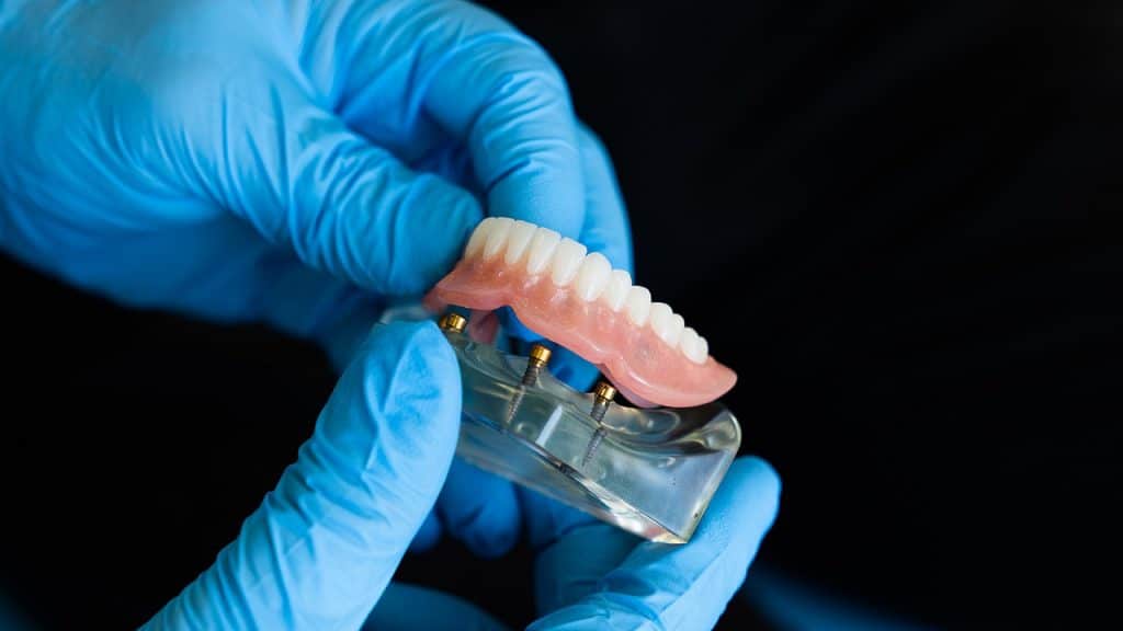 Quelles sont les nouvelles prothèses dentaires ?