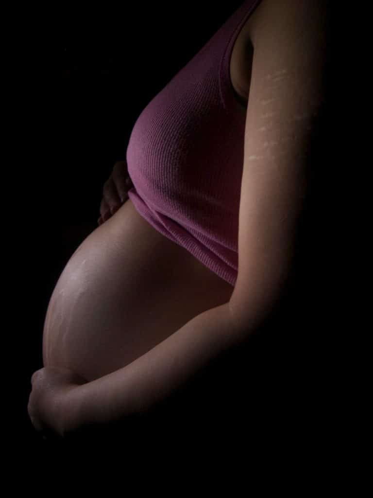 Est-ce que les vergetures disparaissent après grossesse ?