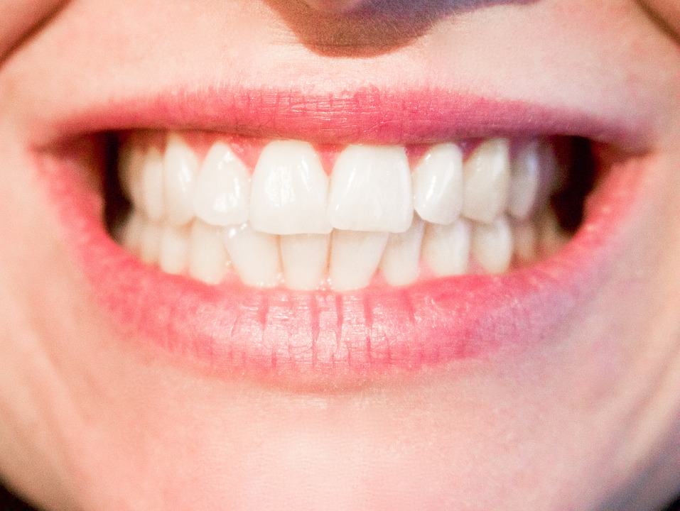 Dentition : qu&rsquo;est-ce qu&rsquo;une prothèse sur implant ?