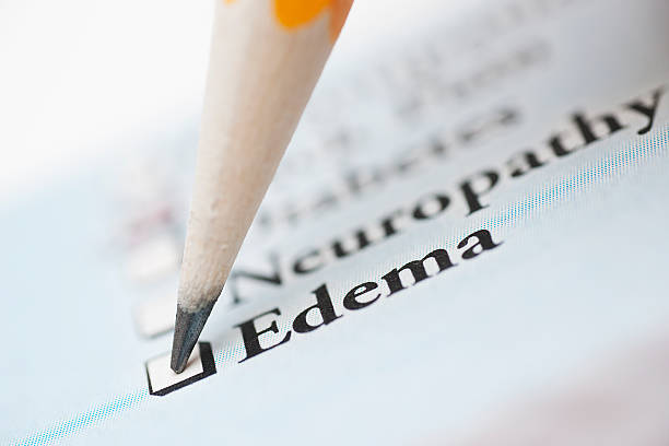 Check list médicale avec la case "Edema", soit "oedème" en français